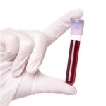 Sedimentacija krvi